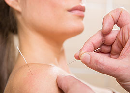 Woman getting Acupuncture Treatment in the Shoulder